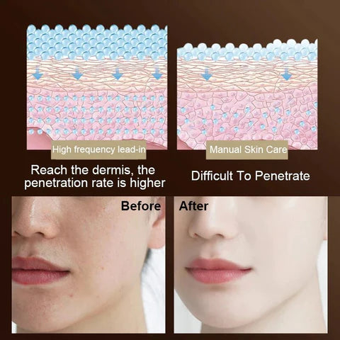 Vibralift: the firming masseur for a neck and radiant face